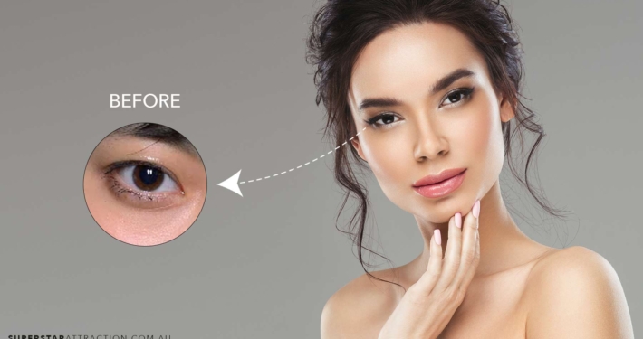 Before & After Eyelash Extensions at Sydney's Best Eyelash Salon